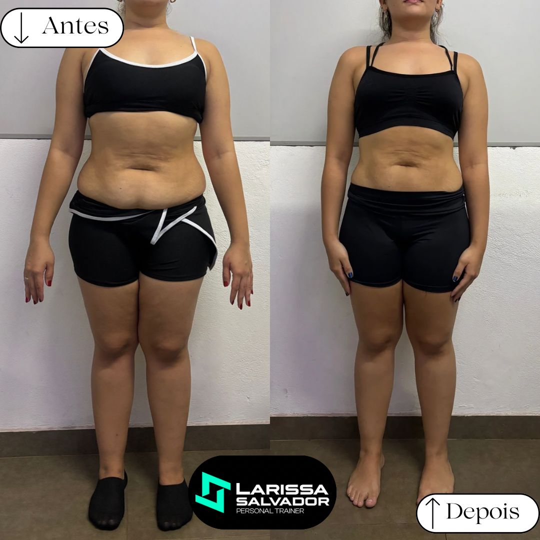 Antes e depois — Resultado 3